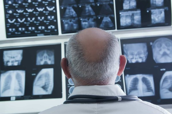 Découvrez les meilleurs outils d'analyse de données pour mieux décider